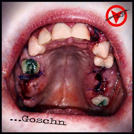 Cover von Southring Gene: ...Goschn